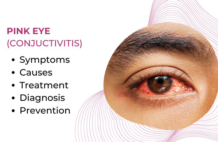 Pink Eye: Causes, Symptoms, and Prevention - Axials Seo