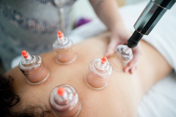 Massage Cupping Therapy: A Modern Twist on an Ancient Practice Therapy